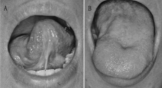 記事のイメージ画像